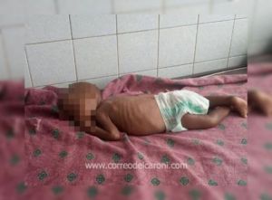 Un niño warao es la nueva víctima de la desnutrición en Ciudad Guayana