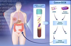 Examen de sangre experimental detecta cáncer de forma precoz