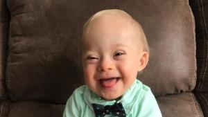 Por primera vez en 90 años de concurso Gerber elige un bebé con síndrome de Down
