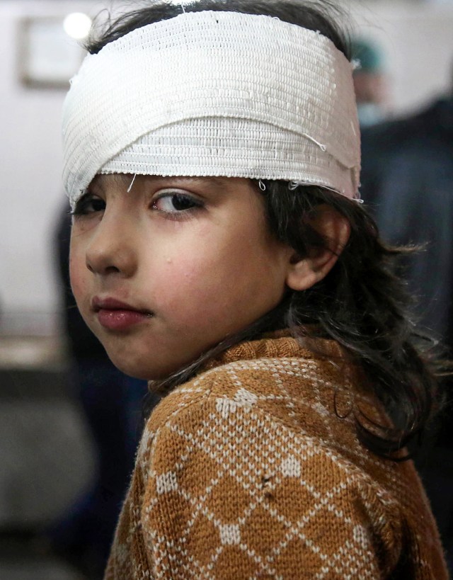 Una niña siria se recupera en un hospital en Kafr Batna tras ser herida durante un bombardeo en Guta Oriental (Siria), el 21 de febrero de 2018. AMMAR SULEIMAN AFP