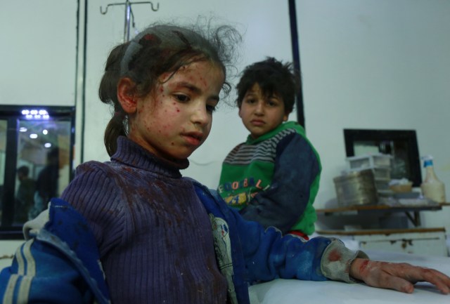 EDITORS NOTE: Graphic content / Two wounded Syrian children wait for medical aid at a makeshift hospital following air strikes by regime forces in the rebel-held town of Douma, in the besieged Eastern Ghouta region on the outskirts of the capital Damascus, on February 23, 2018. Syrian regime air strikes and artillery fire hit the rebel-held enclave of Eastern Ghouta for a sixth straight day killing dozens of civilians, as the world struggled to reach a deal to stop the carnage. / AFP PHOTO / HAMZA AL-AJWEH