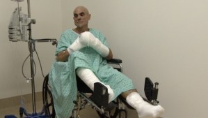 Hombre perdió los pies y una mano por correr a 50 grados bajo cero