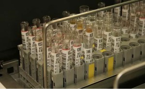 Laboratorio japonés ensayará la detección del cáncer con muestras de orina