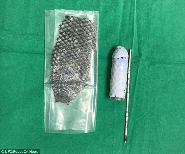 268/5000 La piel del pez se alineó con un molde en forma de vagina que se insertó donde deberían estar sus genitales | Daily Mail