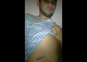 Dirigente de Primero Justicia en Mérida fue atacado con arma blanca (fotos)