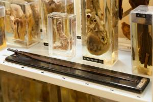 La extraña colección de cuerpos enfermos que fue exhibida en un museo de Londres (Fotos)