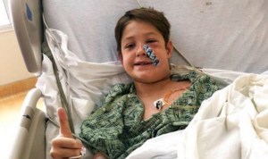 Un milagro… Niño estadounidense sobrevive luego que una brocheta le atravesó la cabeza (FOTO)