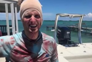 ¡Aterrador! El video del momento en que un tiburón muerde en la cabeza a un pescador que sobrevivió para contarlo