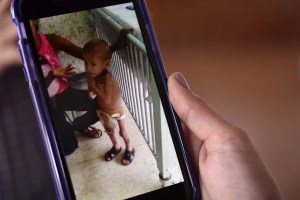 Venezuela retrocede 20 años en mortalidad infantil