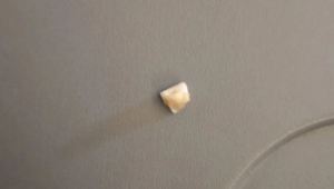 Un pasajero de la mejor aerolínea del mundo encontró un diente humano en la comida (foto)