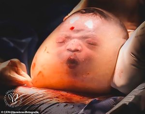 FOTOS: Así nace un bebé “enmantillado”