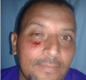 Denuncian agresión a docentes que protestaban en contra de Maduro en Los Teques