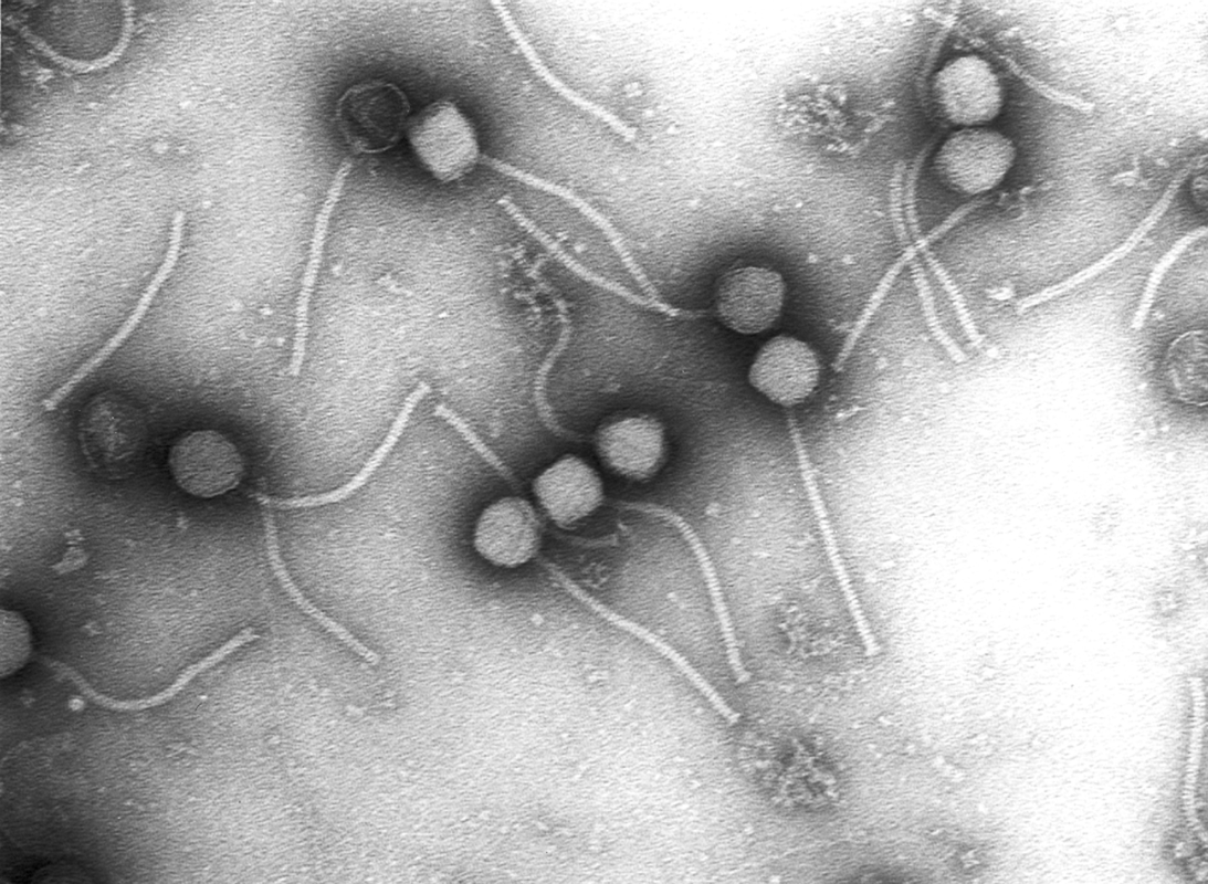 Virus de alcantarillas: Una alternativa a los antibióticos que empieza a concretarse