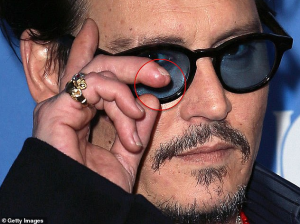 Johnny Depp demandó a su ex por usar una botella rota para mocharle… el dedo (Foto Sensible)
