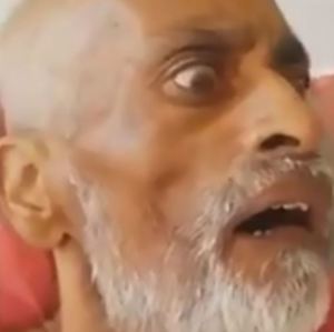 ¡No veas esto! Anciano en Sudáfrica contrajo gusanos en la boca por mala higiene (Video Sensible)