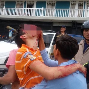 Médico confirma que menor herido en Táchira perdió la vista (Video)