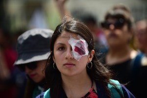Un estudiante perdió la vista tras recibir graves heridas durante las protestas en Chile