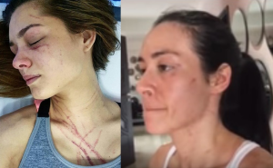 ¡Dos años después de la golpiza! Diosa Canales reveló porqué atacó a Osmariel Villalobos (CAPTURA)