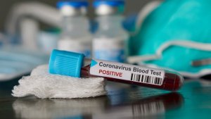 Fallece una persona por coronavirus en Guyana