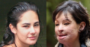 Natalia Ponce, la mujer que le desfiguraron el rostro posó en traje de baño por una buena causa (FOTOS)