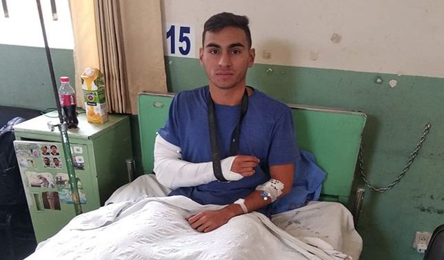 Venezolano denunció que un policía peruano le fracturó el brazo solo por tropezarlo