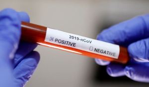 Coronavirus: Nueve datos optimistas para evitar el pánico ante la pandemia