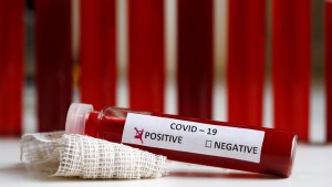 El extraño método que usará EEUU para tratar a pacientes con coronavirus