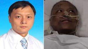 El extraño cambio en el color de la piel de dos médicos que sobrevivieron al coronavirus en Wuhan