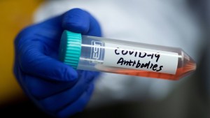 Un anticuerpo de un sobreviviente del Sars revela una vulnerabilidad potencial al coronavirus