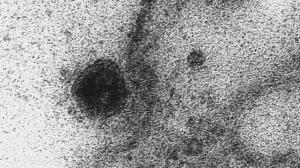 Estudian si medicamento experimental contra el cáncer puede evitar los contagios por coronavirus