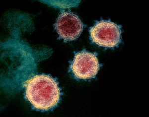 Vacuna contra el coronavirus de la Universidad de Oxford funcionó exitosamente en monos