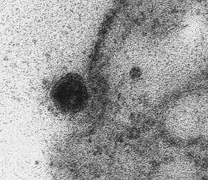 Captan imágenes del momento exacto en que coronavirus infecta una célula (Video)
