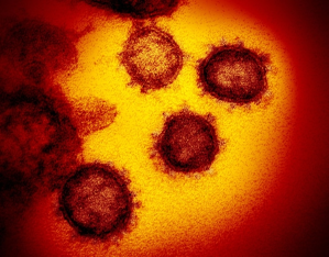 “La chispa que provoca el incendio”: Qué cantidad de coronavirus es suficiente para infectar a una persona