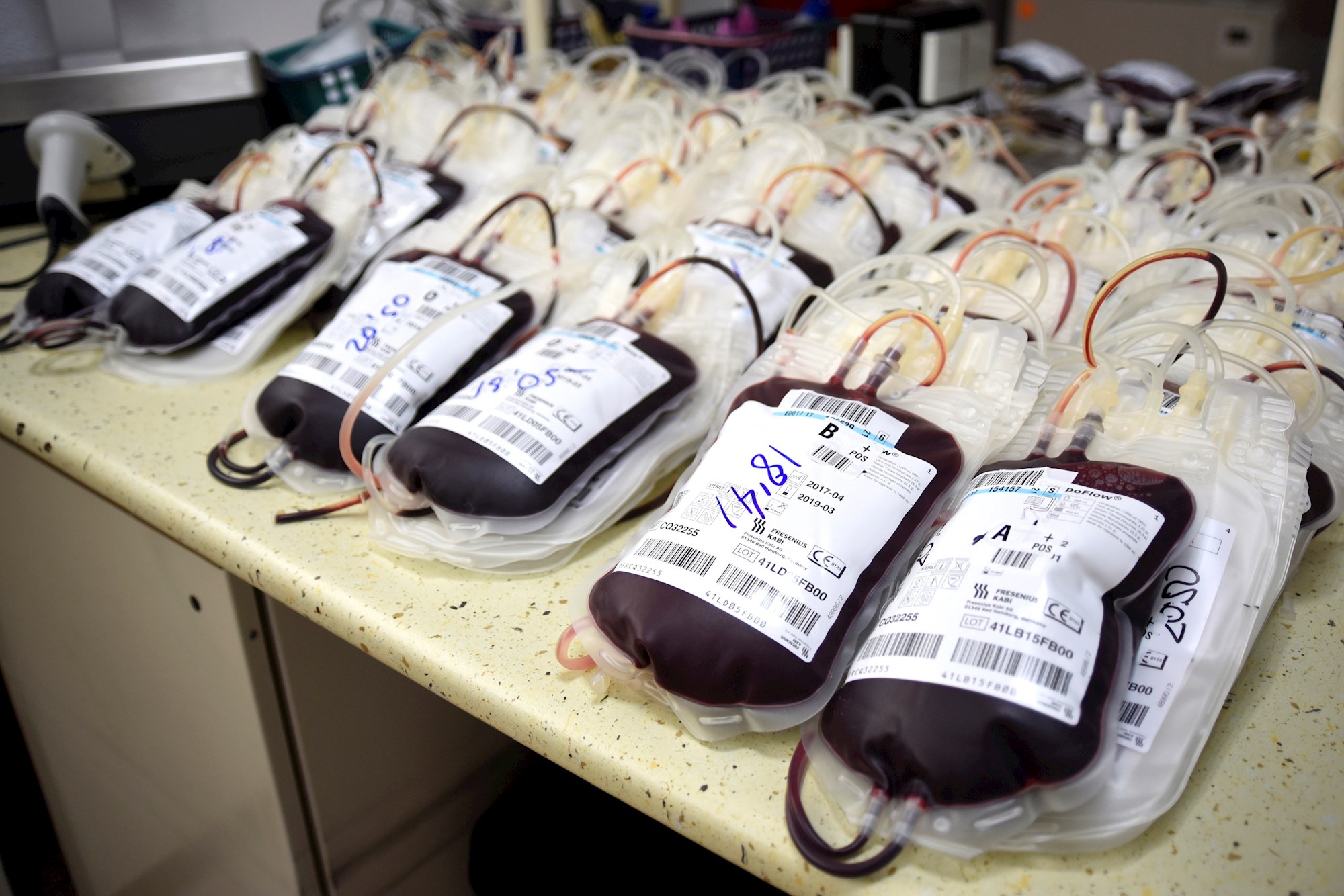 Covid-19 disminuye la donación de sangre altruista en Latinoamérica