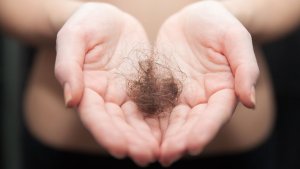 Estrés, cambios de clima o genética: Las causas de la caída del cabello en la cuarentena