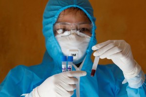 Más de 685.000 muertos por la pandemia del coronavirus en el mundo