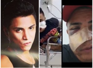 En video: Le disparan a actor en el rostro para robarle el teléfono