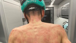 EN FOTOS: Granizada castiga a un grupo de ciclistas en plena carrera dejando terribles y dolorosas marcas