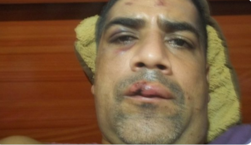 En fotos: Padre de periodista en Caracas fue agredido por la GNB mientras hacía una cola por gasolina