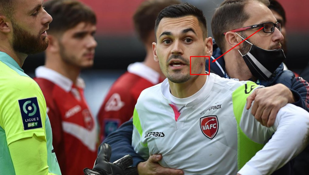 FOTO: Futbolista en Francia se acercó a su rival para decirle algo… ¡y le mordió un cachete!