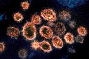 Identifican el primer caso de la variante brasileña del coronavirus en EEUU