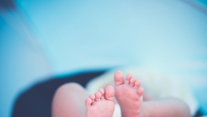 Bebé que nació con tres penes es el primero caso en el mundo, afirman los médicos