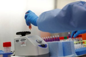 FDA advirtió que las nuevas mutaciones del Covid-19 pueden afectar el resultado de los tests