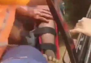 Tras caer del techo de una casa en Anzoátegui solo le diagnosticaron una fractura (Video)