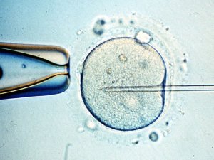 Fertilidad humana en peligro: Mayoría de parejas tendrían que ir a reproducción asistida para 2045