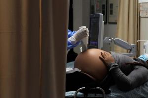 El aumento de muertes en embarazadas por Covid-19 inquieta a Brasil