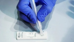 Laboratorio suizo fabricó un test para diferenciar el Covid-19 de la gripe