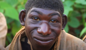 Vivió en la selva de Ruanda durante años para huir de las burlas en la escuela por su apariencia