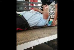 PoliZulia herido fue trasladado en un camión al hospital por falta de ambulancias (Video)