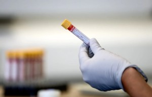 Solo con una gota de sangre: Un prometedor test permite la detección temprana de 50 tipos de cáncer